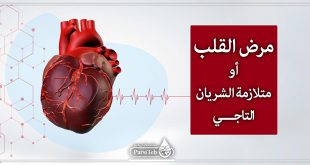 مرض القلب أو متلازمة الشريان التاجي