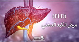 مرض الكبد الدهني FLD