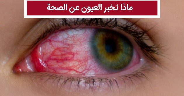 ماذا تخبر العيون عن الصحة
