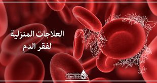 العلاجات المنزلية لفقر الدم