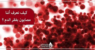 أعراض فقر الدم؛ كيف نعرف أننا مصابون بفقر الدم؟