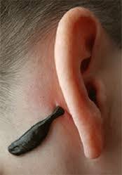 علاج الأمراض المستعصية بالعلق الطبي- العلق وراء الأذن