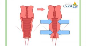 عملية التجميل بارسی طب