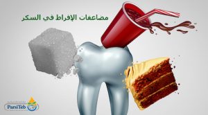 تسوس الأسنان من مضاعفات الإفراط في السكر