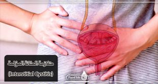 متلازمة المثانة المؤلمة (Interstitial Cystitis)