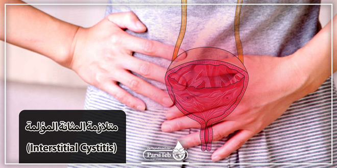 متلازمة المثانة المؤلمة (Interstitial Cystitis)